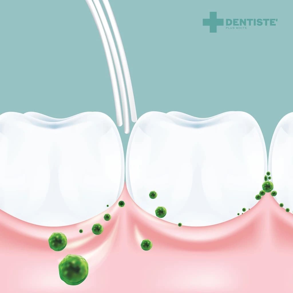 Dentiste' [สินค้าขายดี] Dentiste 6580 Gum แปรงสีฟัน ป้องกันเหงือกร่น ทำความสะอาดล้ำลึก ขนแปรง 6,580 เส้น มากกว่าทั่วไป 4 เท่า https://lnwchill.com