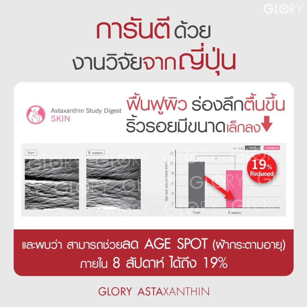 GLORY Astaxanthin แอสต้าแซนธิน 6 mg แคปซูล Capsules Astareal + Grape Skin Extract + Co Q10 + Vit E วิตามินผิวเด็ก สารสกัดจาก สาหร่ายสีแดง สาหร่ายฮีมาโตค็อกคัส พลูวิเอลิส https://lnwchill.com